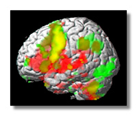 fMRI Brain Scan